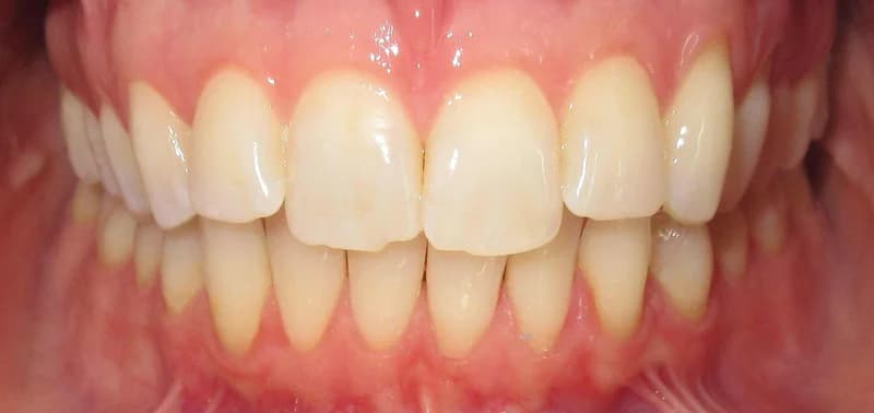 Smile design Before and After - Dental Salon, before photo