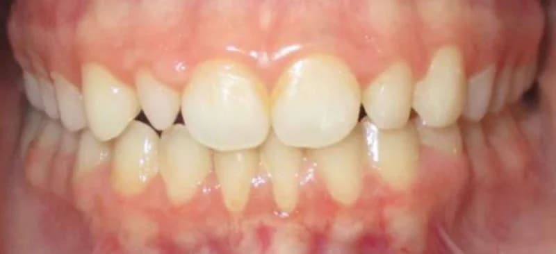 Smile design Before and After - Dental Salon, before photo