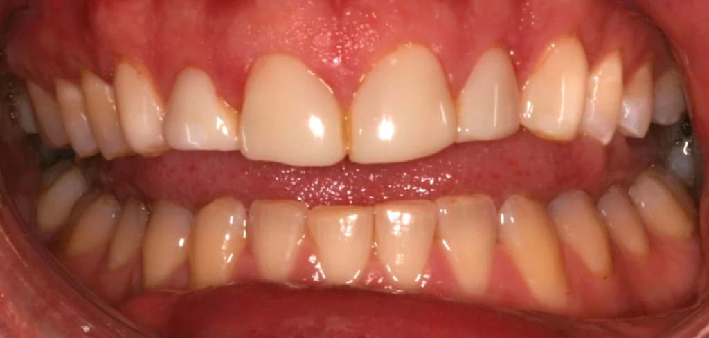Smile design Before and After - Dental Salon, before photo