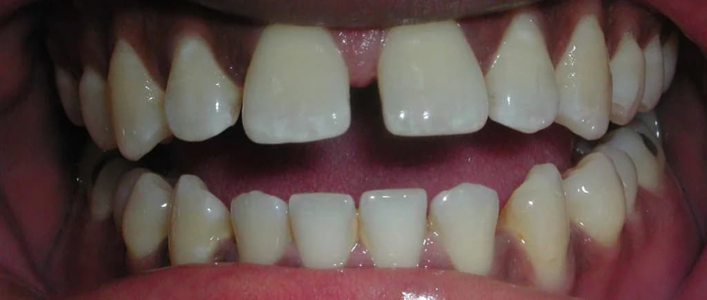 Smile design Before and After - Dental Salon, before photo