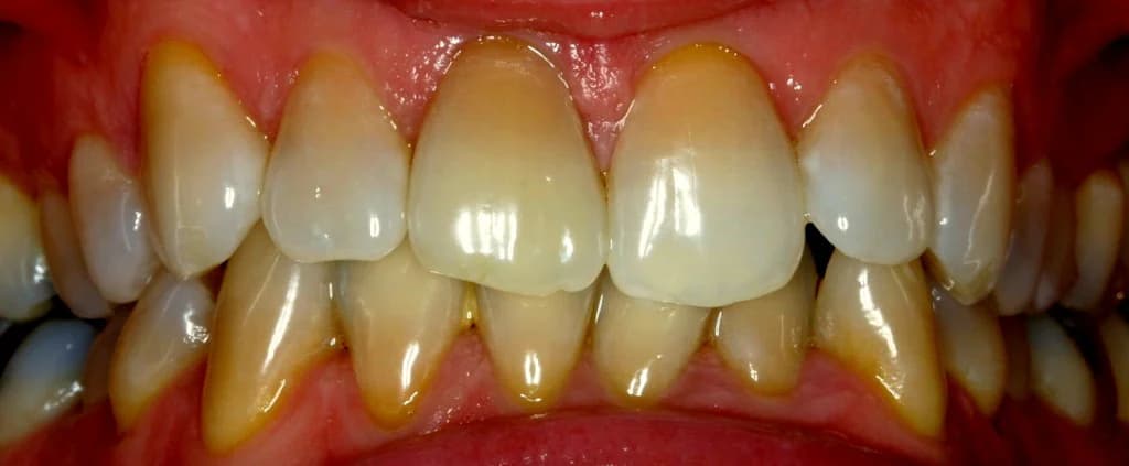 Smile design Before and After - Dental Salon, before photo