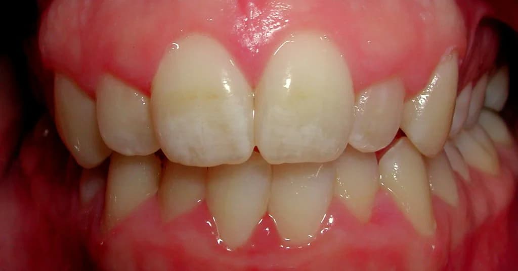 Smile design Before and After - Dental Salon, before photo