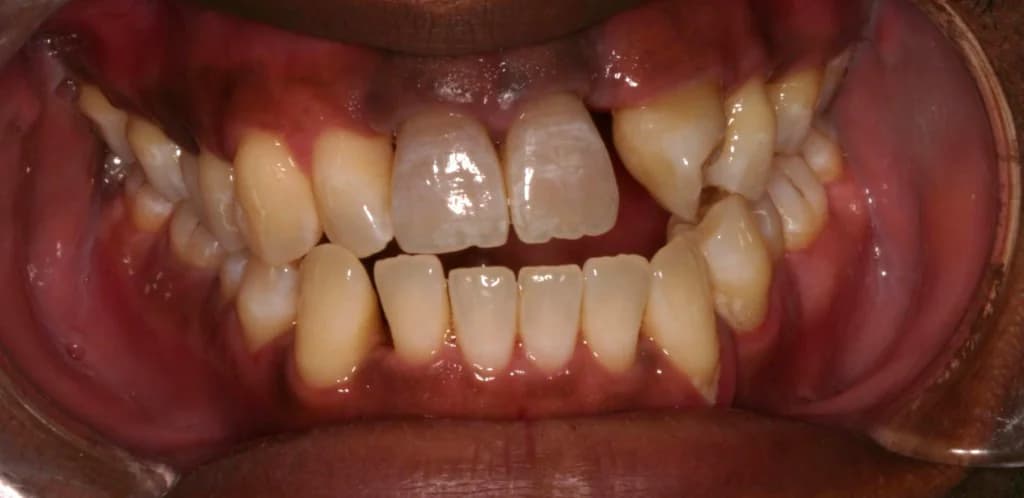 Smile design Before and After - Dental Salon, before photo