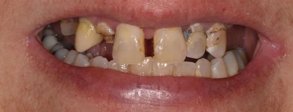 Smile design Before and After - Dental Salon, before photo