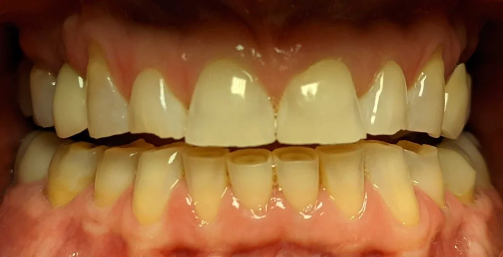 Smile design Before and After - Dental Salon, before photo