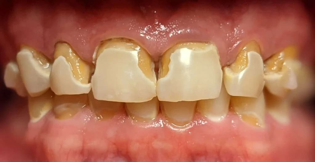 Smile design Before and After - Dental Salon, before photo