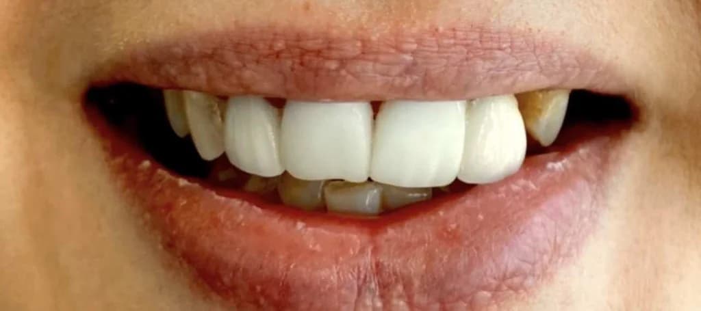 Smile design Before and After - Dental Salon, before photo