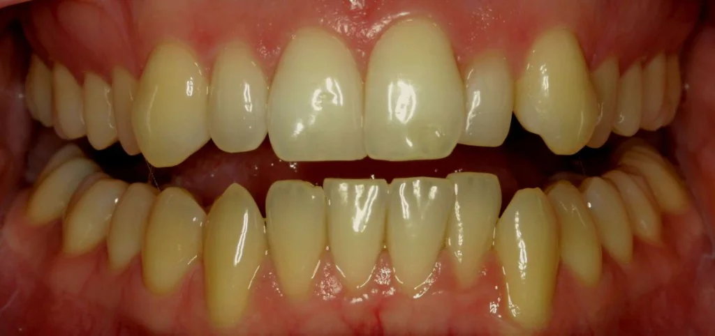 Smile design Before and After - Dental Salon, before photo
