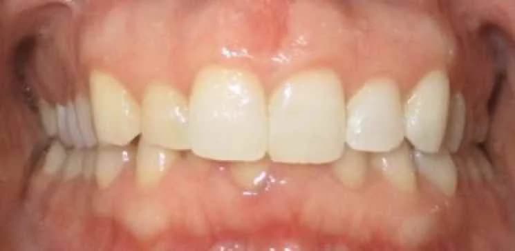 Smile design Before and After - Dental Salon, before photo